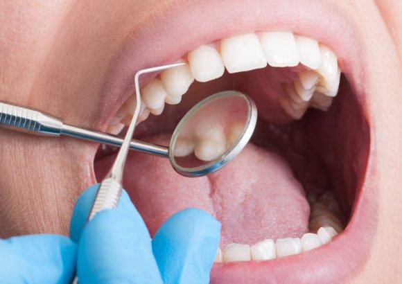 Oral Surgery