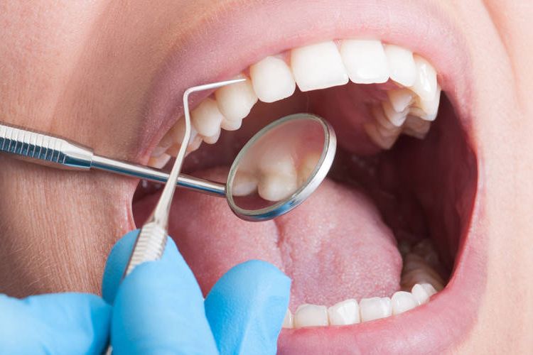 Oral Surgery
