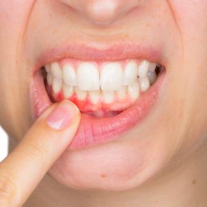 Periodontology Periodontology