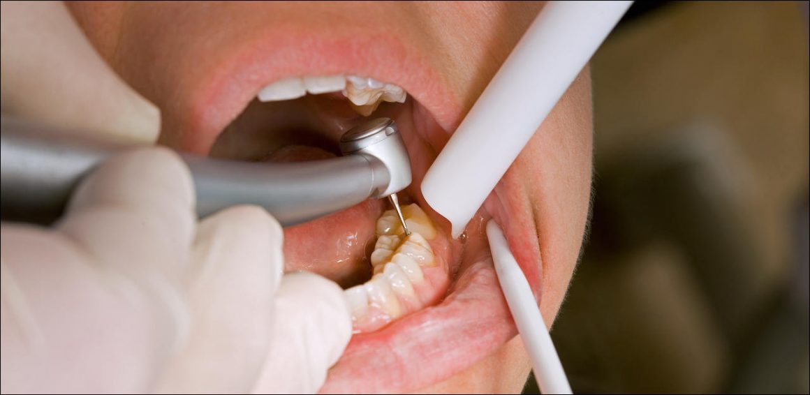 teaserbreit Conservative Dentisry