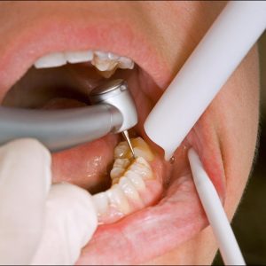 Conservative Dentisry