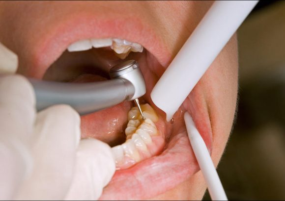 Conservative Dentisry